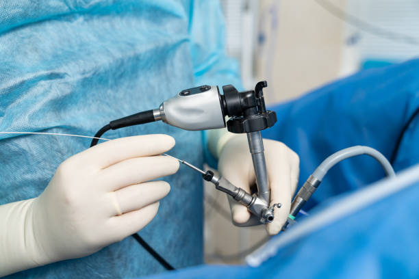Snipping Away: Exploring the Applications of the Endoscopic Snare in Gastrointestinal Procedures