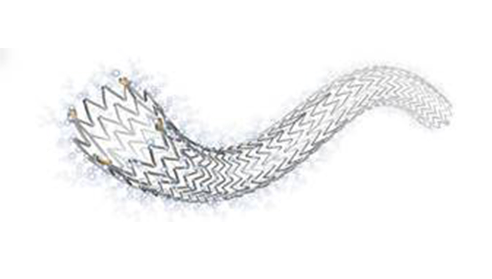 Peripheral Stent