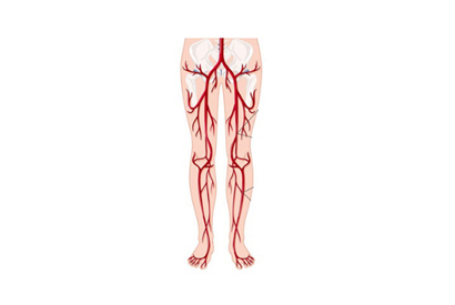 Peripheral Vascular Products
